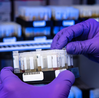 Antibodies_Testing_Image
