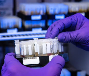 Antibodies_Testing_Image